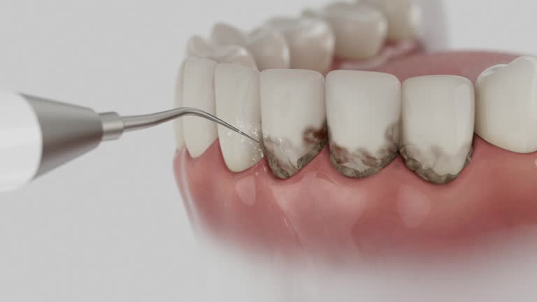 Trusted Teeth Cleaning And Checkup service in Luxora, AR - Dentist Open Now